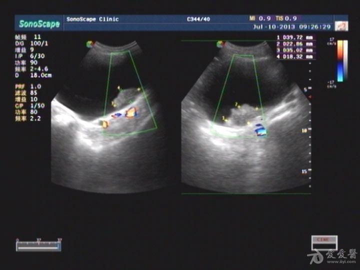 超聲醫學討論版 - 愛愛醫醫學論壇 - 愛愛醫醫學網