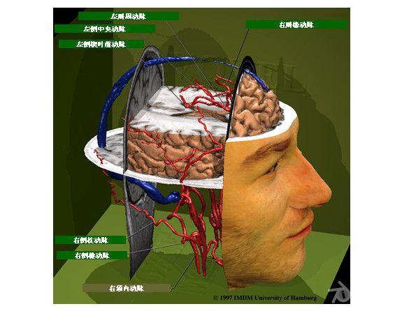 人脑和脑血管解剖分析