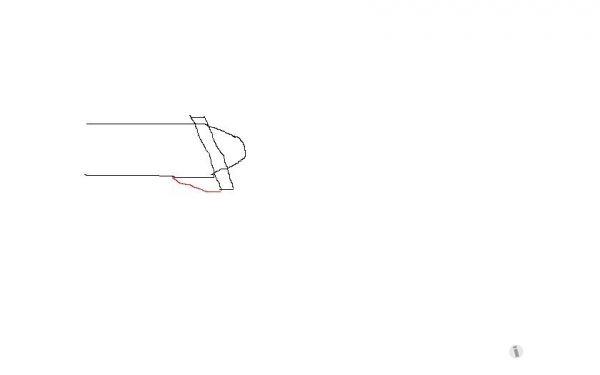 因为包茎去做了包皮手术,上商环的,但是这个手术做得非常不理想,第一