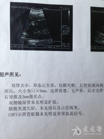 肾脏有占位 求解各位医生(图已上传)