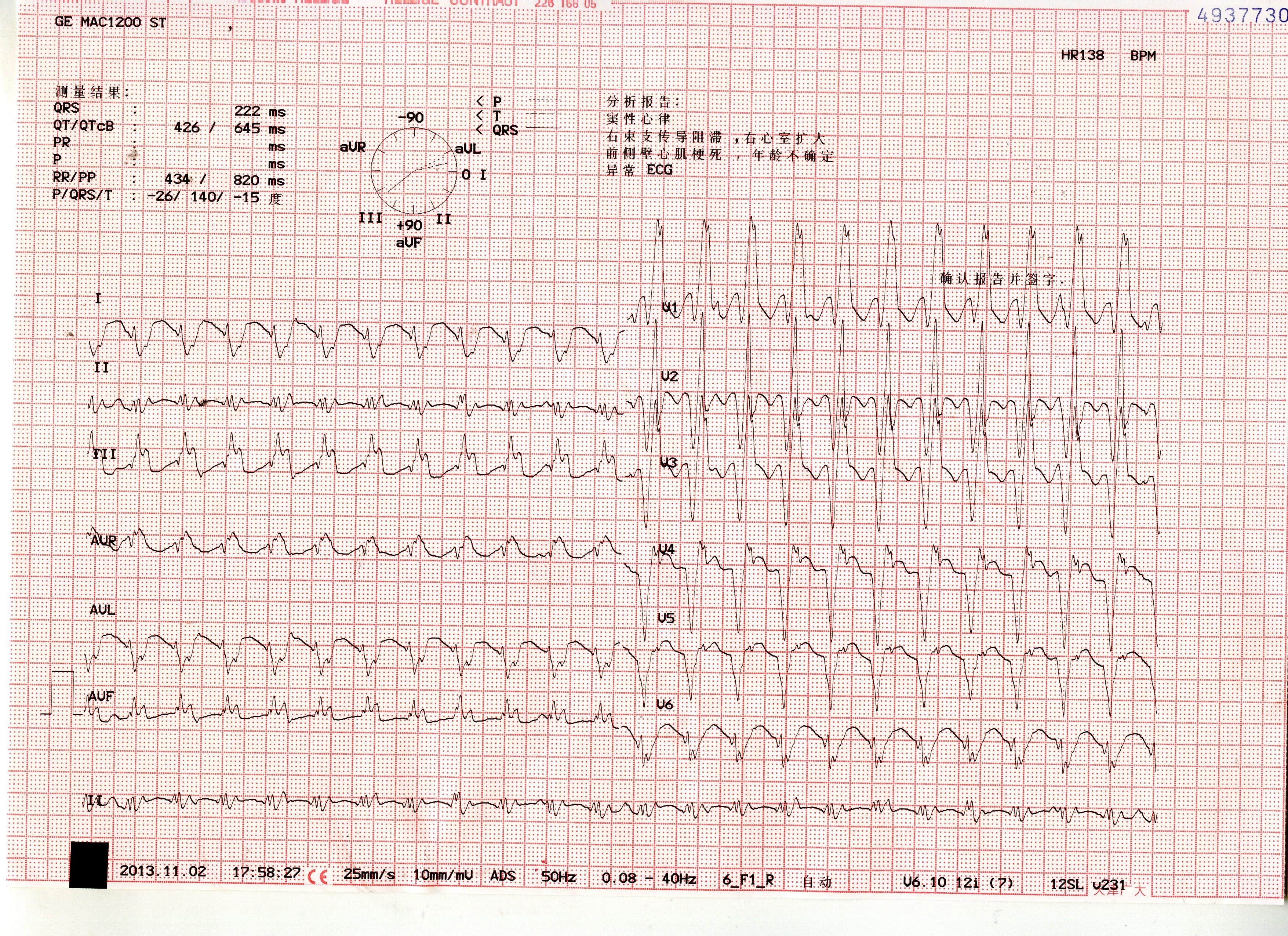 幫看這份心電圖