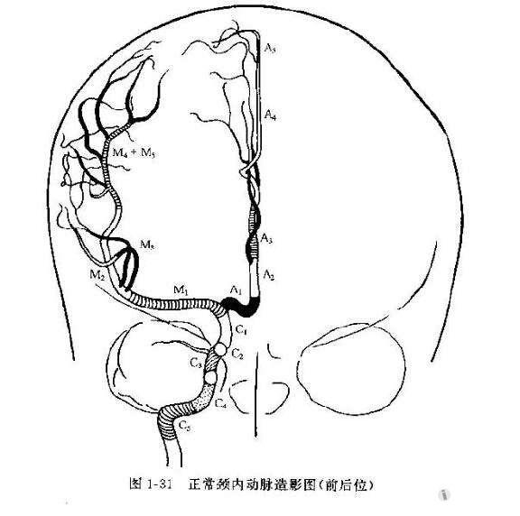 颈内动脉分段七段法