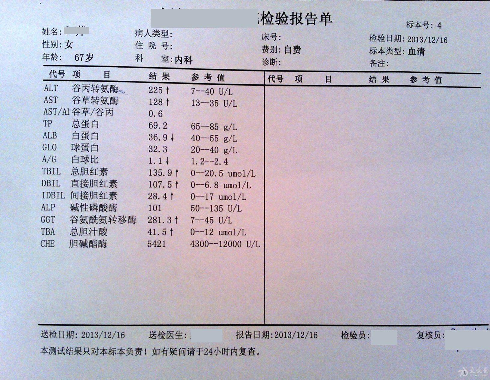 胆囊炎检查结果图片图片