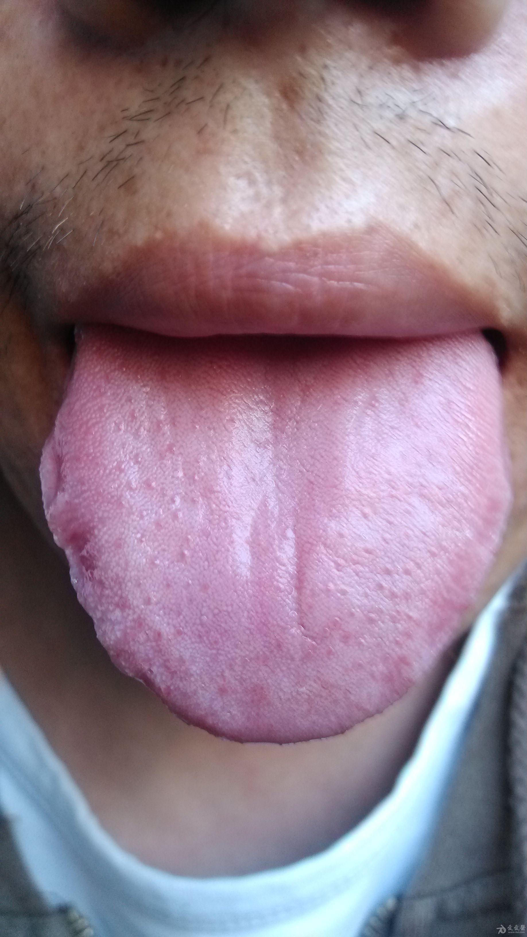 显微镜下的舌头图片