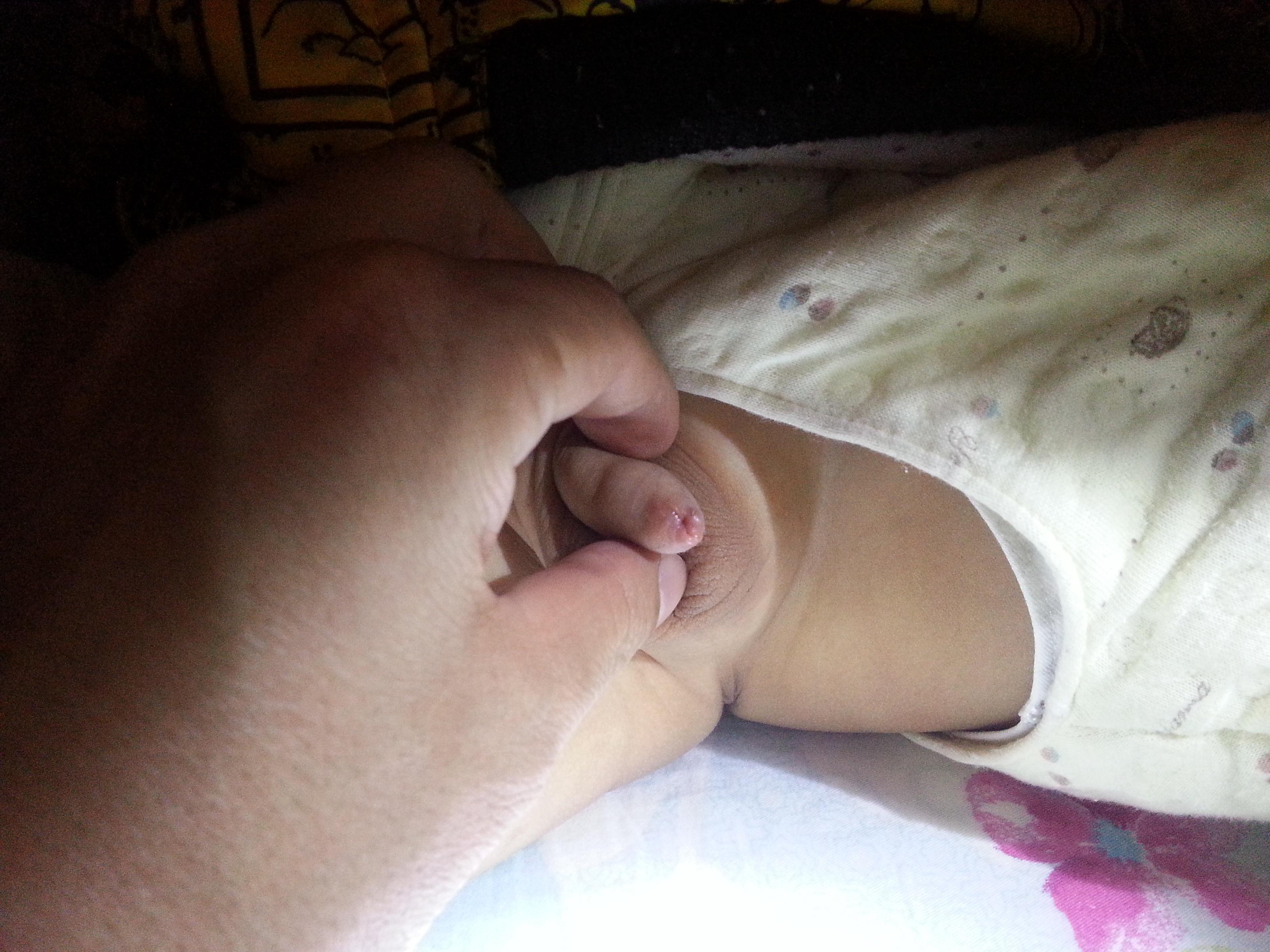 三个月男宝宝睾丸图片图片