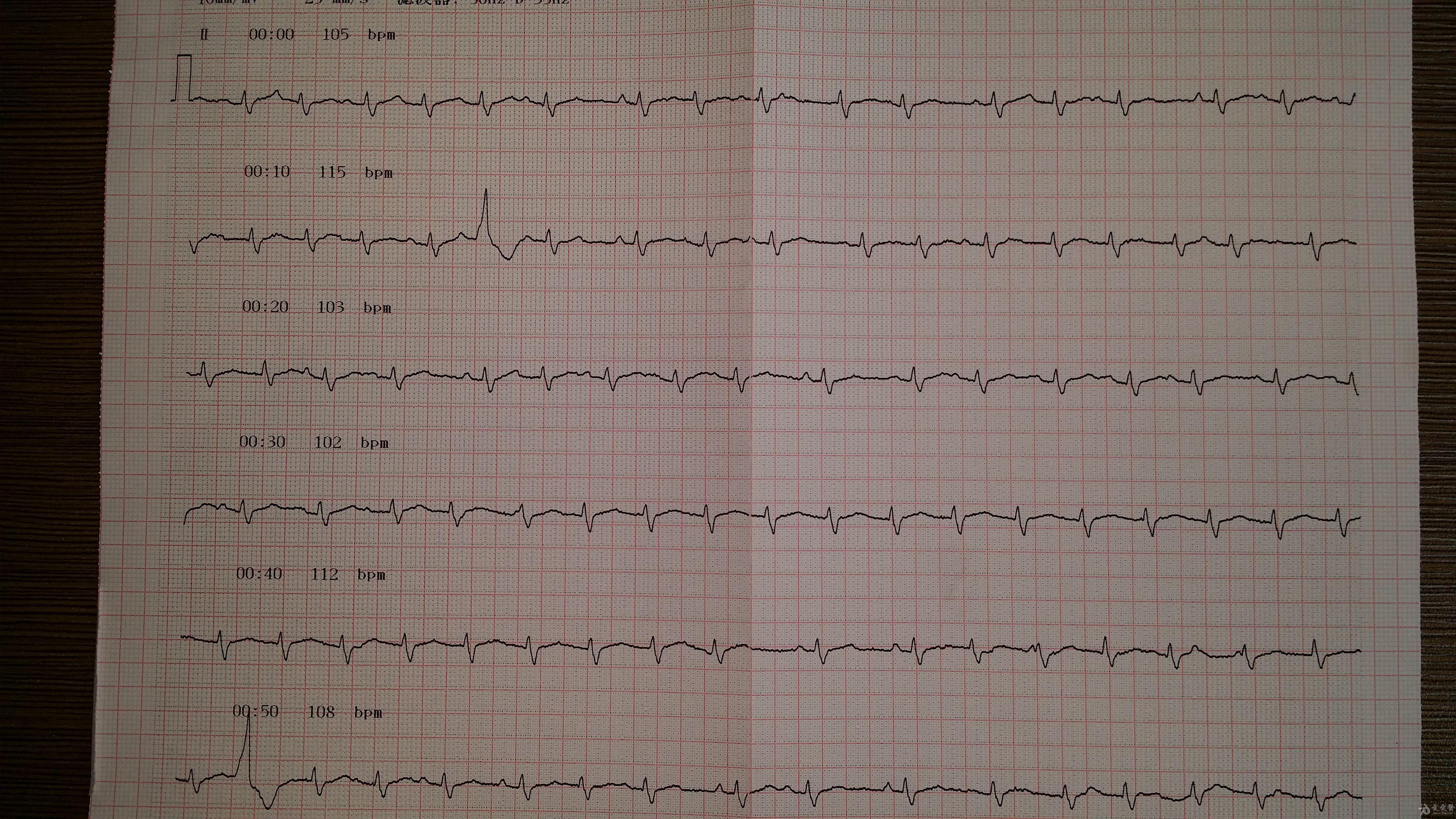 心电图脑电图专业讨论版 - 爱爱医医学论坛 - 爱爱医医学网