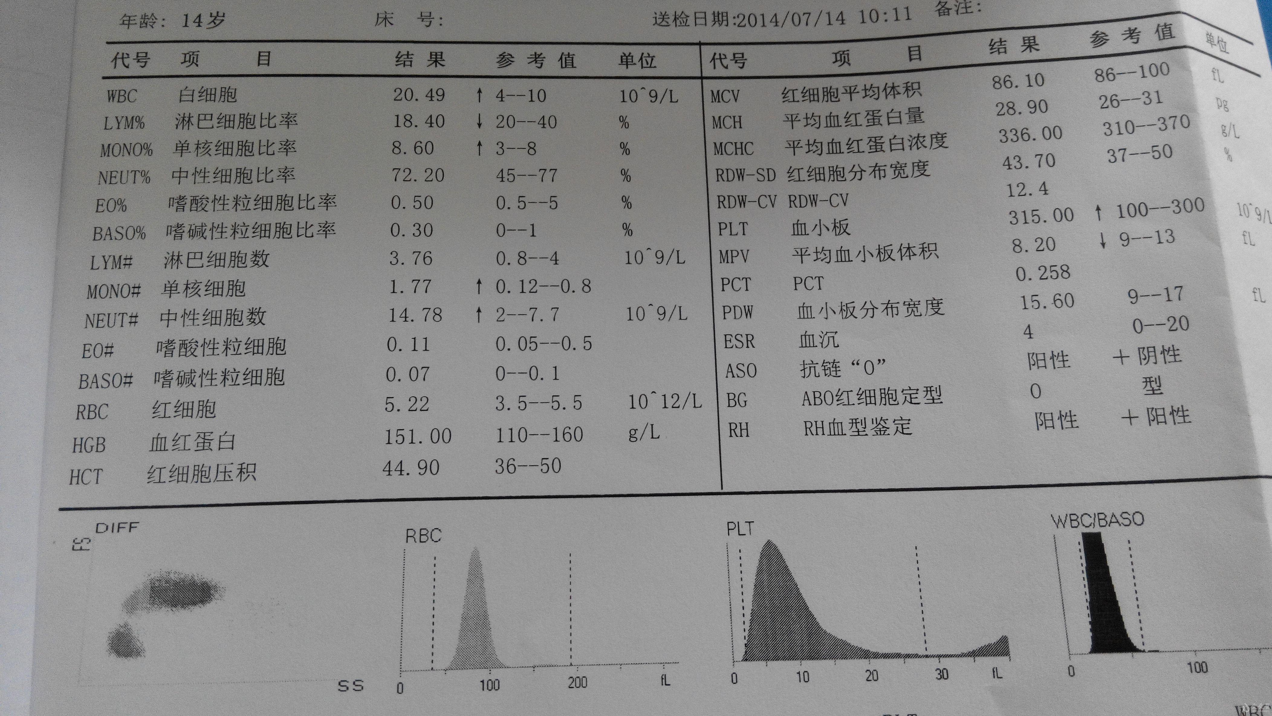 腮腺炎应该挂什么科图片