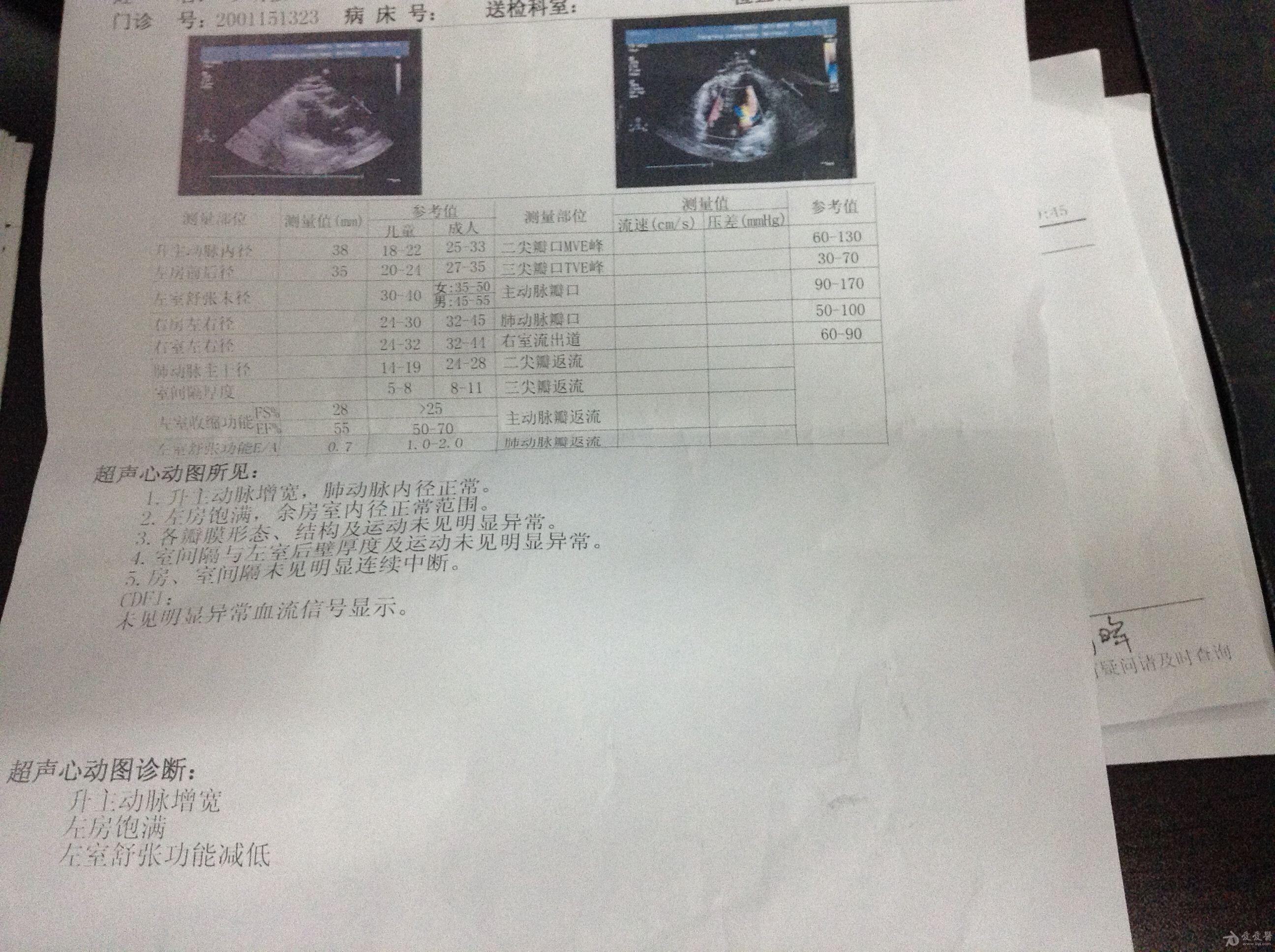 发张超声心动图请大家判断有可能是什么疾病