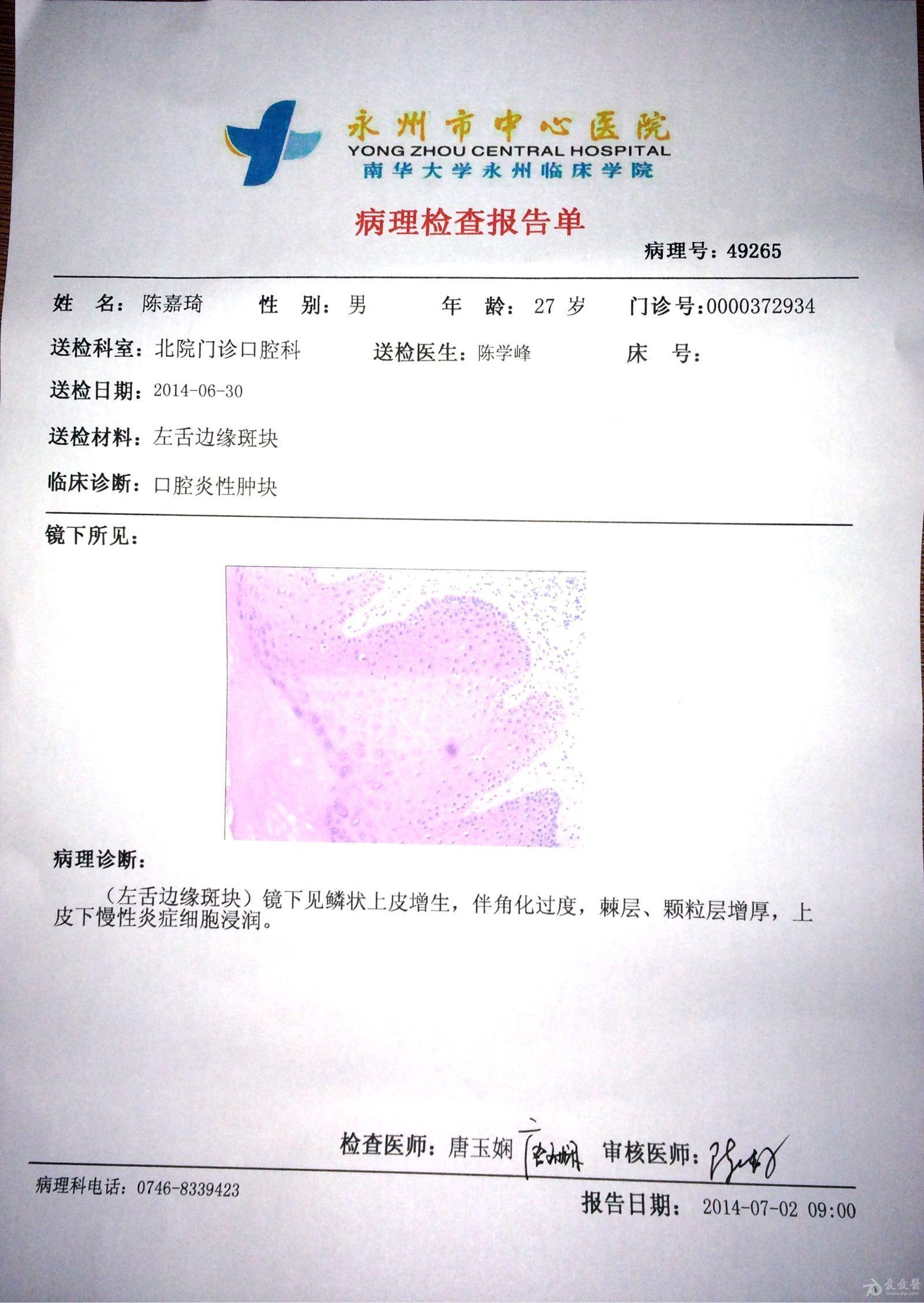 求助——口腔黏膜白斑要怎么办