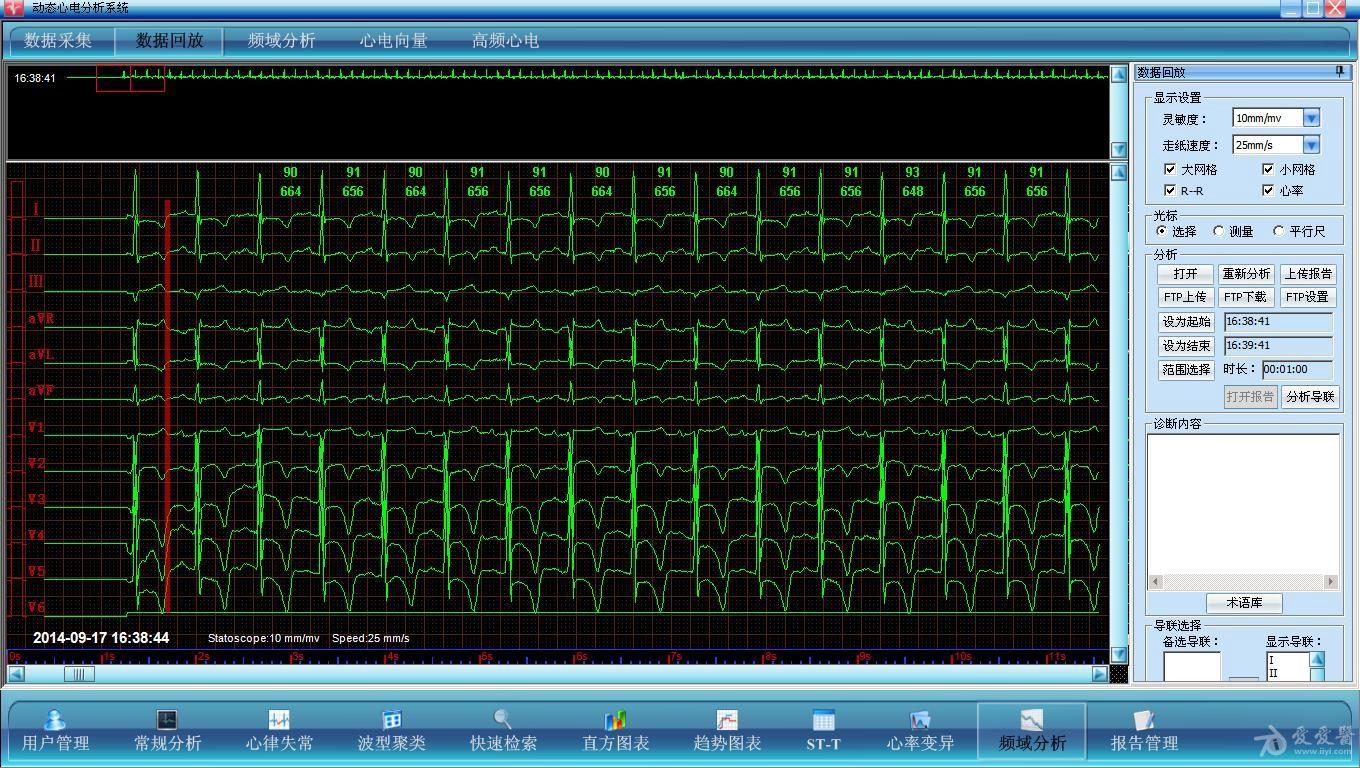 心电图脑电图专业讨论版 - 爱爱医医学论坛 - 爱爱医医学网