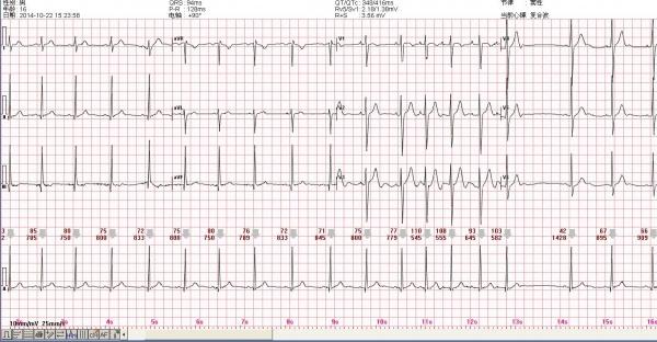 心電圖腦電圖專業討論版 - 愛愛醫醫學論壇 - 愛愛醫醫學網