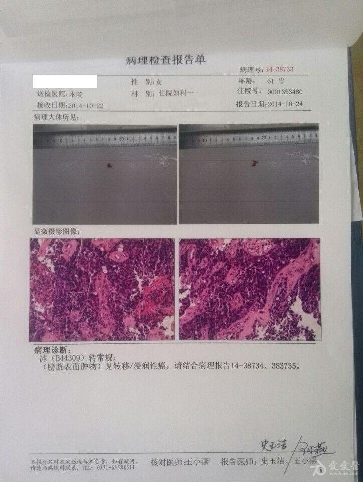 一例卵巢癌三期c治療方案的討論