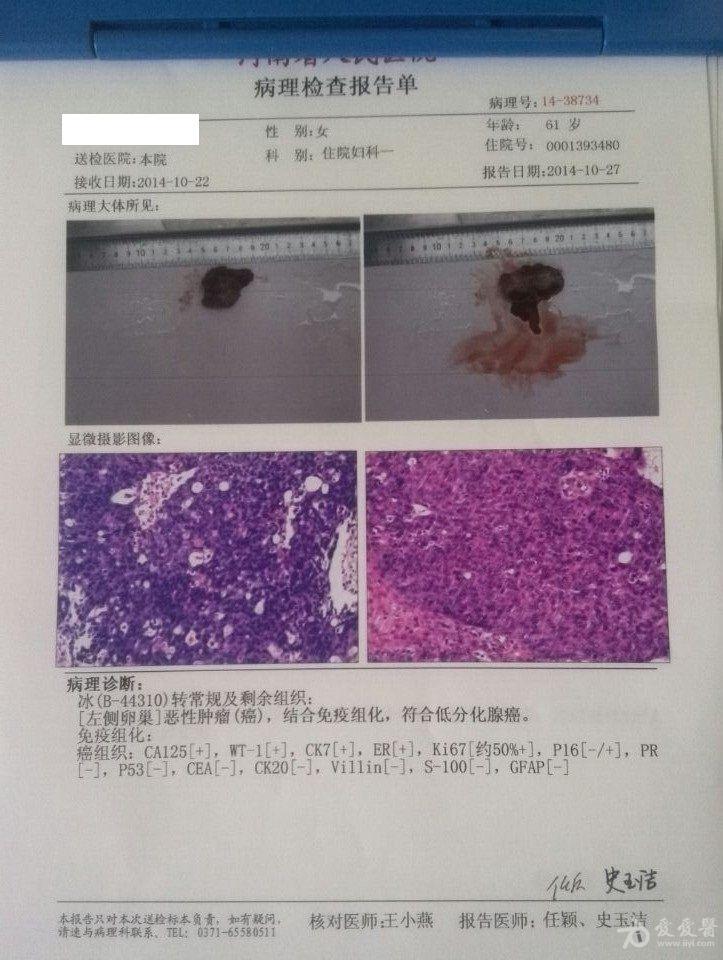 肿瘤要做病理切片吗？