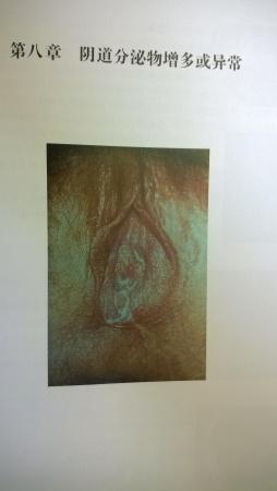 男性阴囊表皮溃烂图片