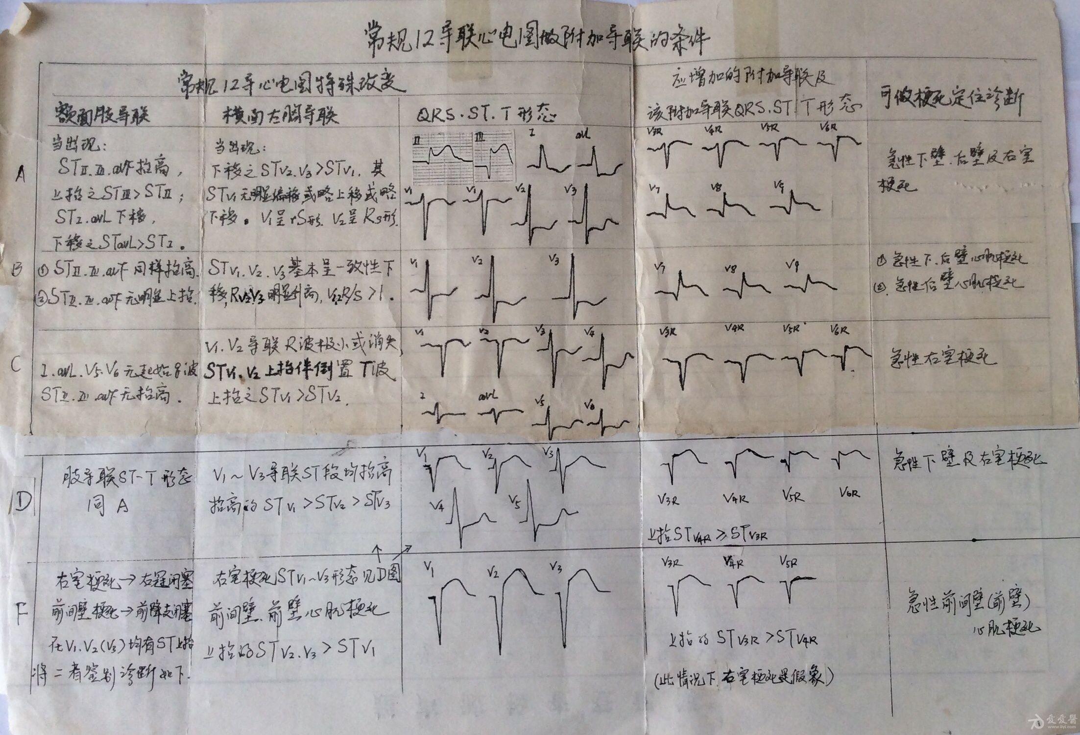 十二导联心电图 标准图片