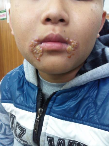 怎么处理比较好