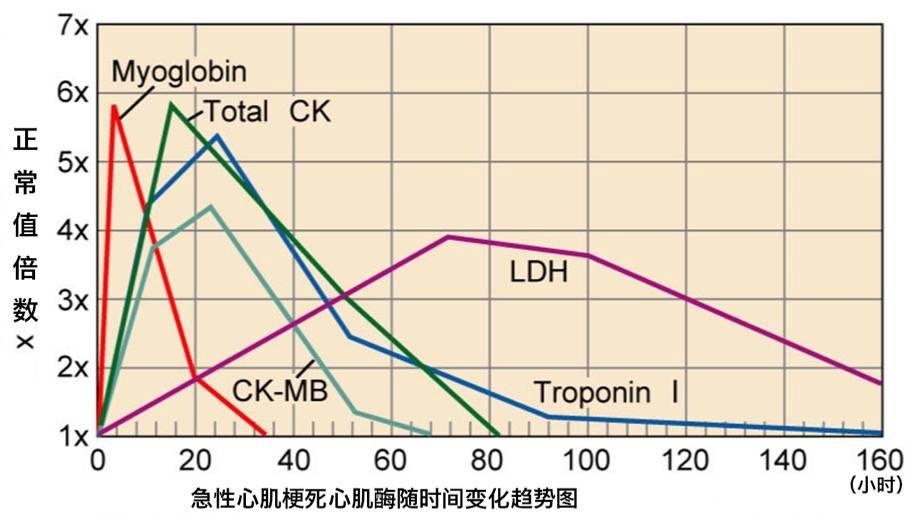 心肌酶图谱图片