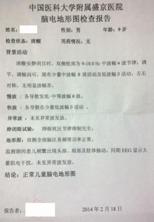 小儿抽动症如何用针灸治疗?