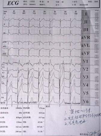 請看這份心電圖