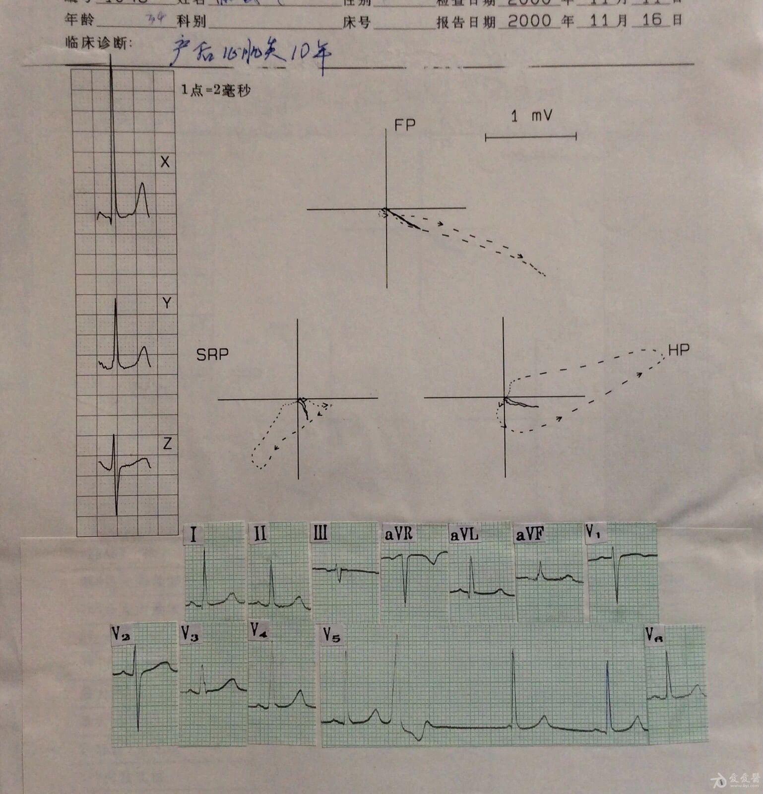 心电向量图报告模板图片