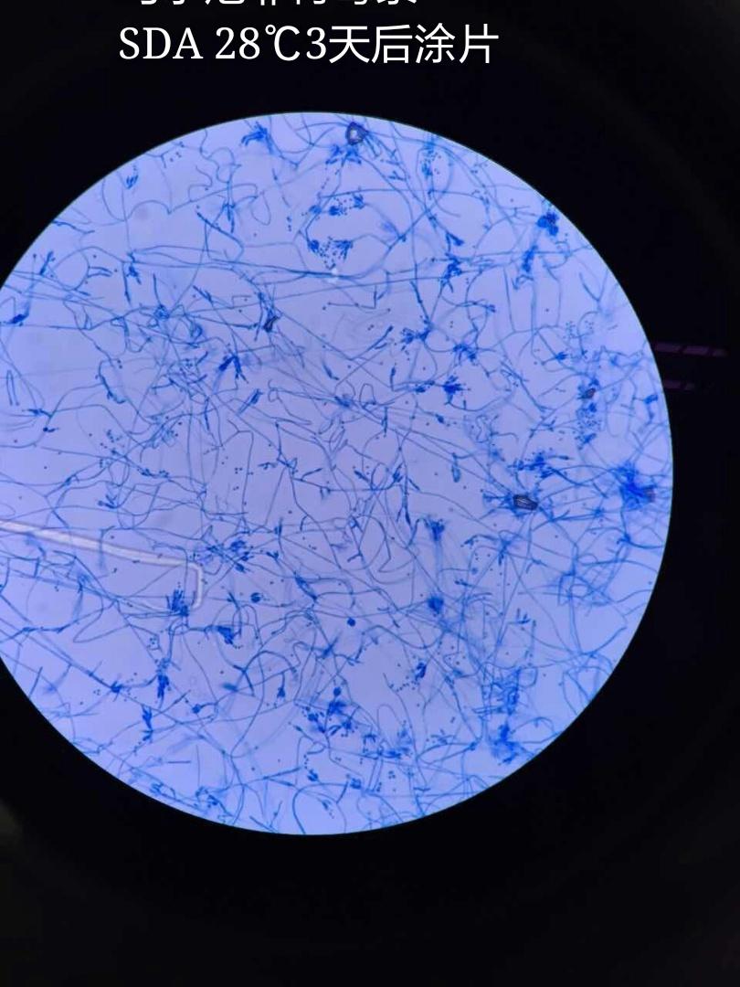 显微镜下的青霉菌图片