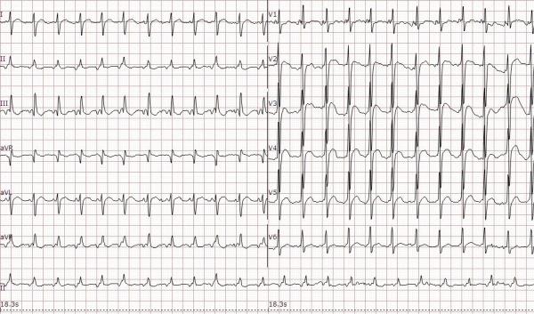请老师帮忙看下图