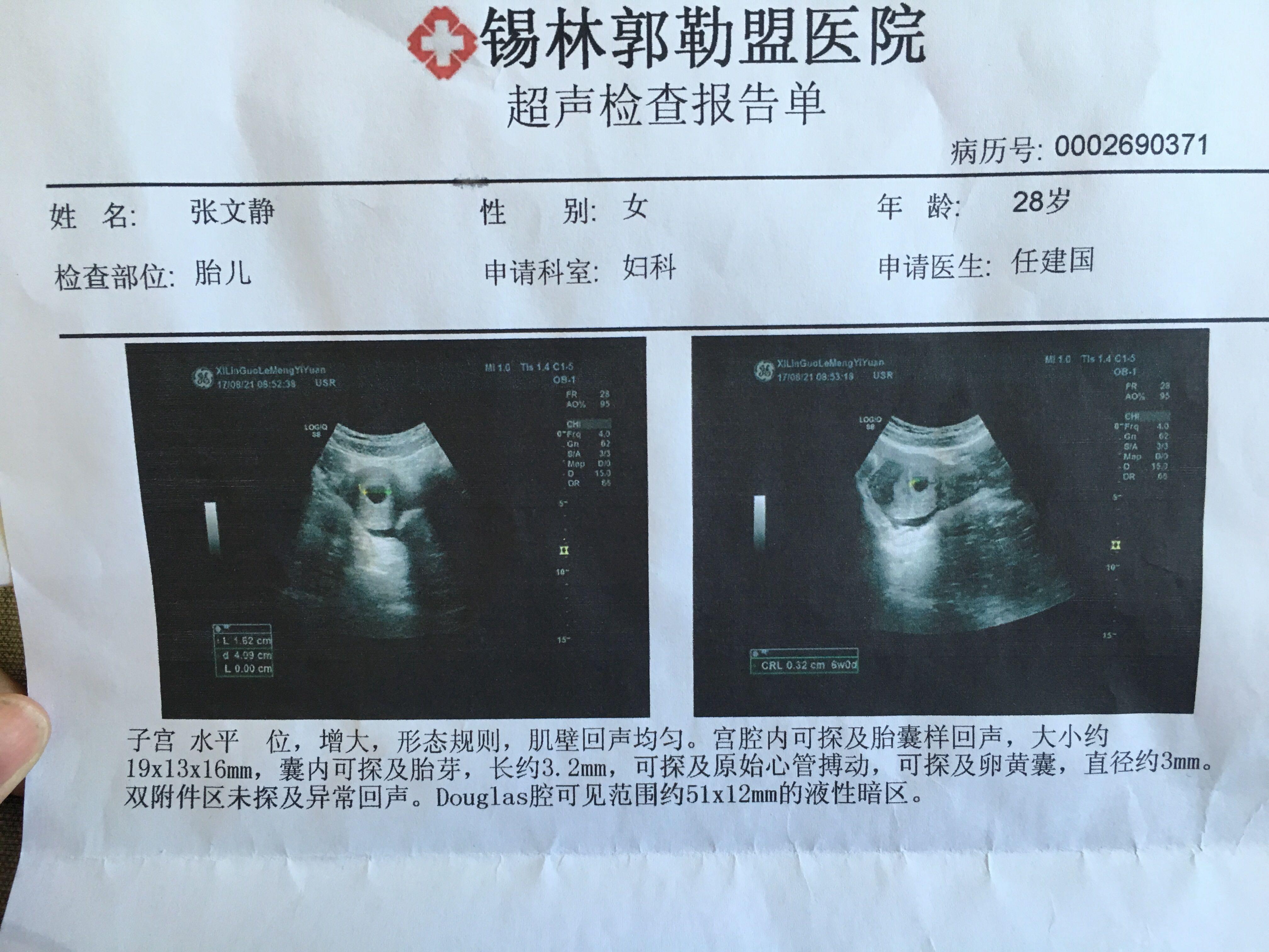拜托各位老师给看一下这是怀孕六周的体检报告