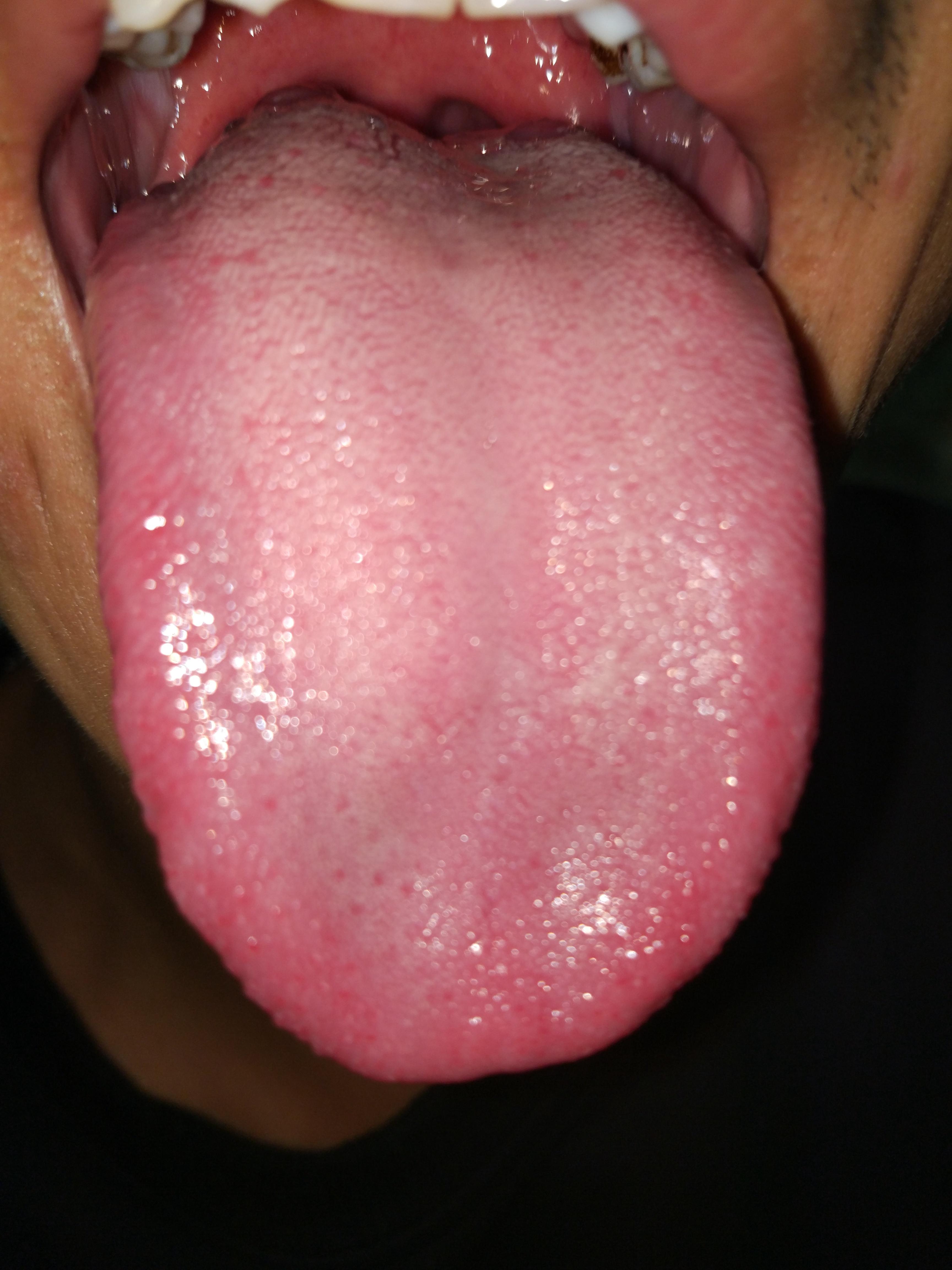 请各位老师帮我辩证一下舌照