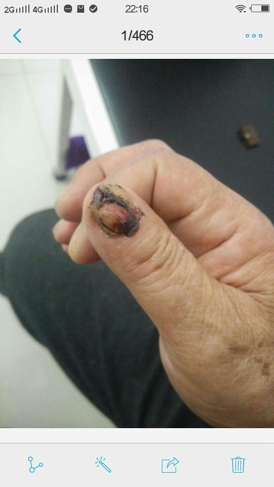 看看这个手指头