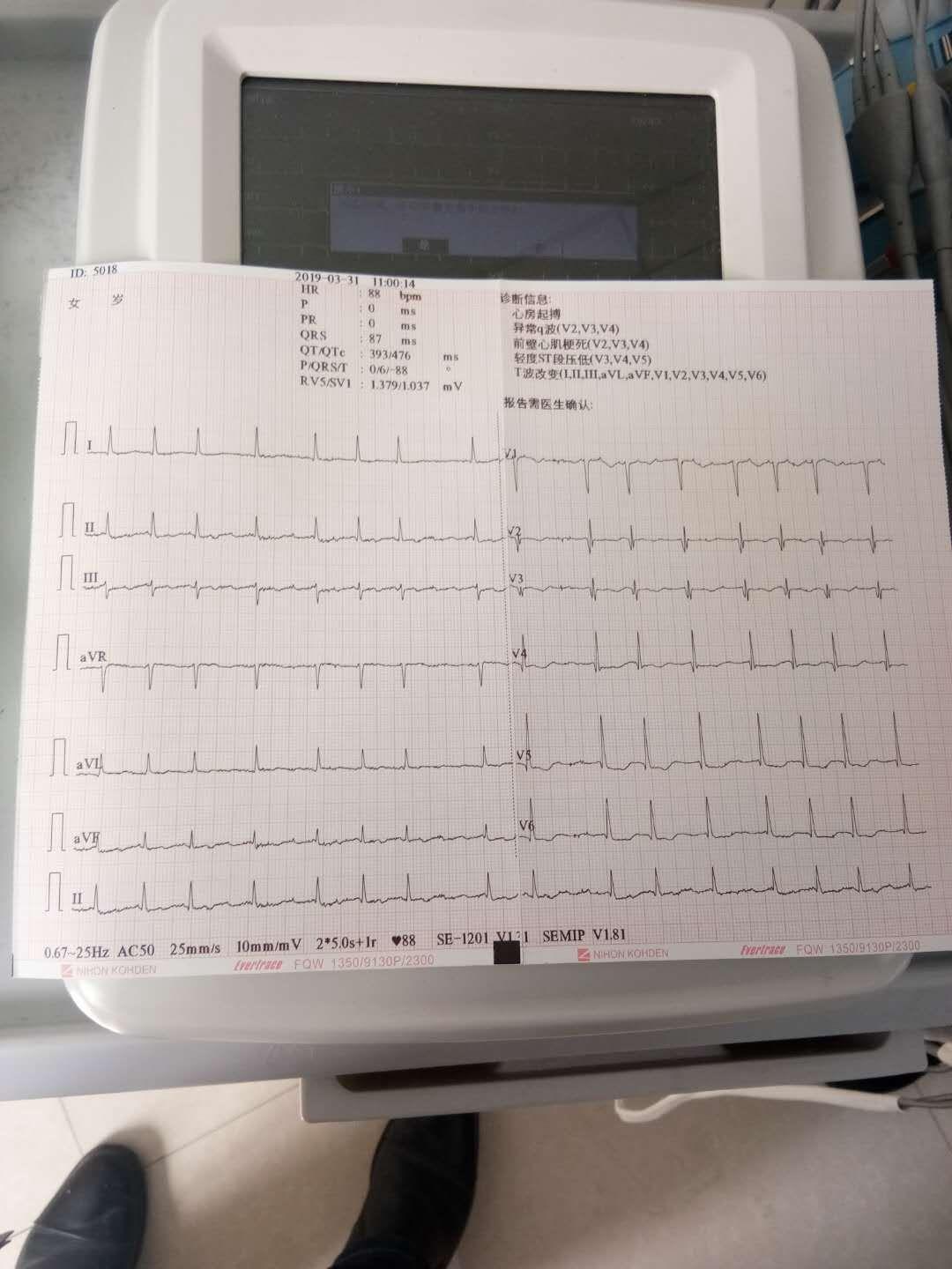 请问这份心律不齐