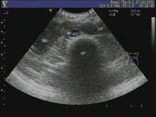 【讨论】给大家几幅超声图片看看 - 超声医学讨论版 - 爱爱医医学论坛