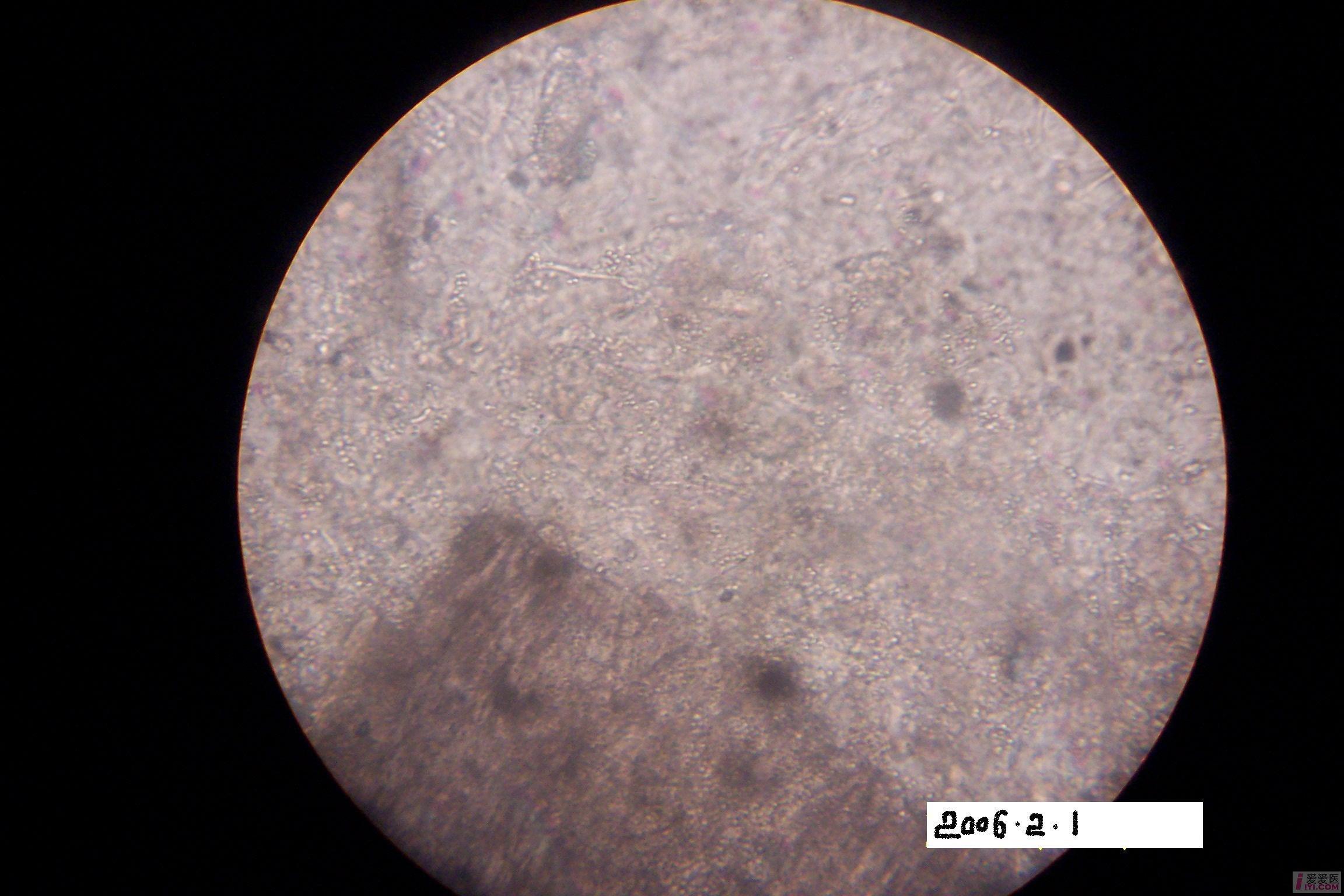 【原创】大面积头癣一列