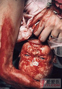 真实拍摄:厕所生小孩全过程--血腥恐怖没人性后的深思