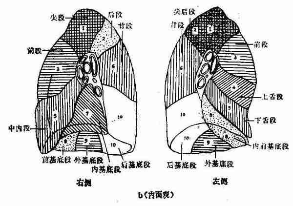 【討論】右上後段還是右上前段肺炎?