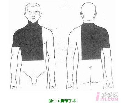 乳房手术消毒范围图片图片