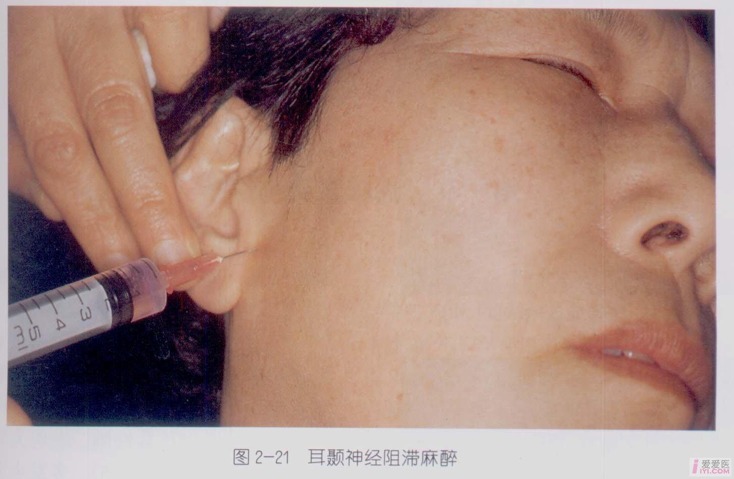 贴图口腔麻醉图片