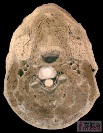 颈部横断面图片