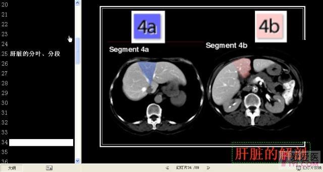 肝脏分段ct图谱图片