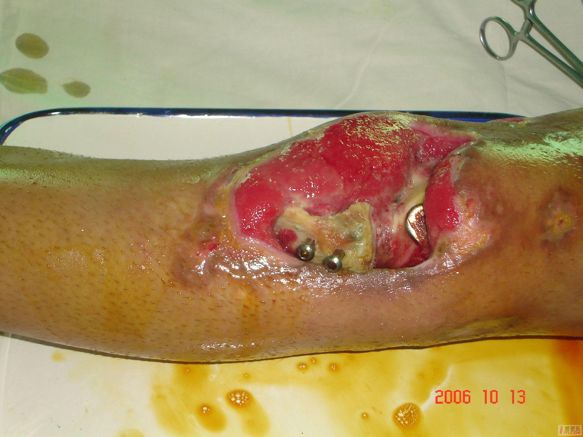 求助大家看看这怎么处理好