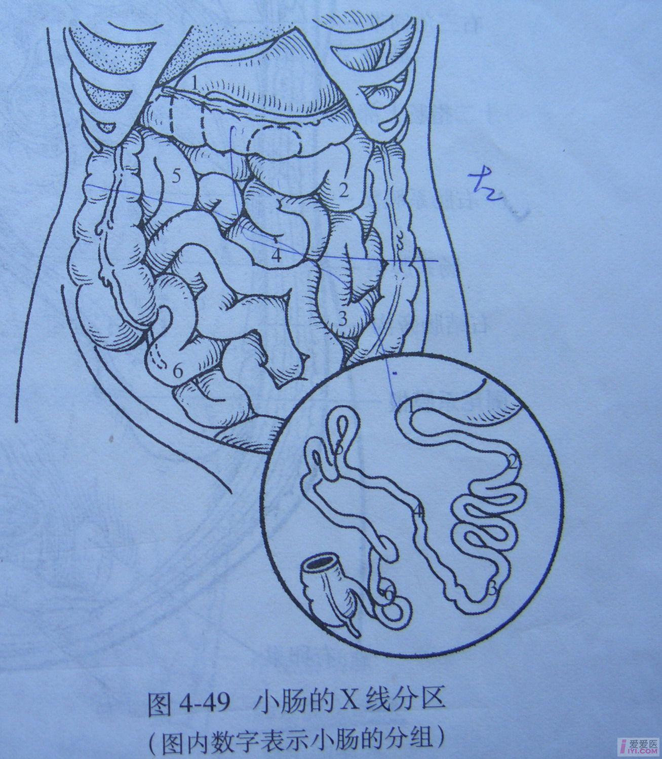 小肠分组图片