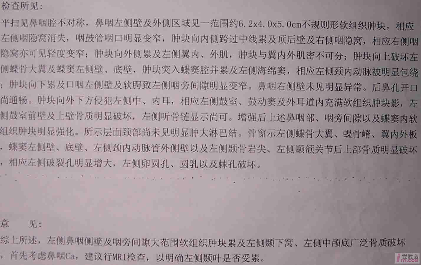 病例讨论以耳部侵犯为首发症状的鼻咽癌