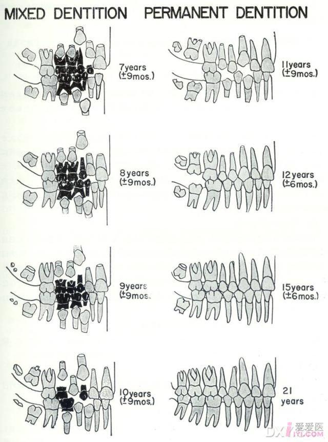 牙体长轴图片图片