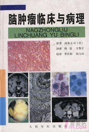 【资源】脑肿瘤临床与病理(阅读权限5)