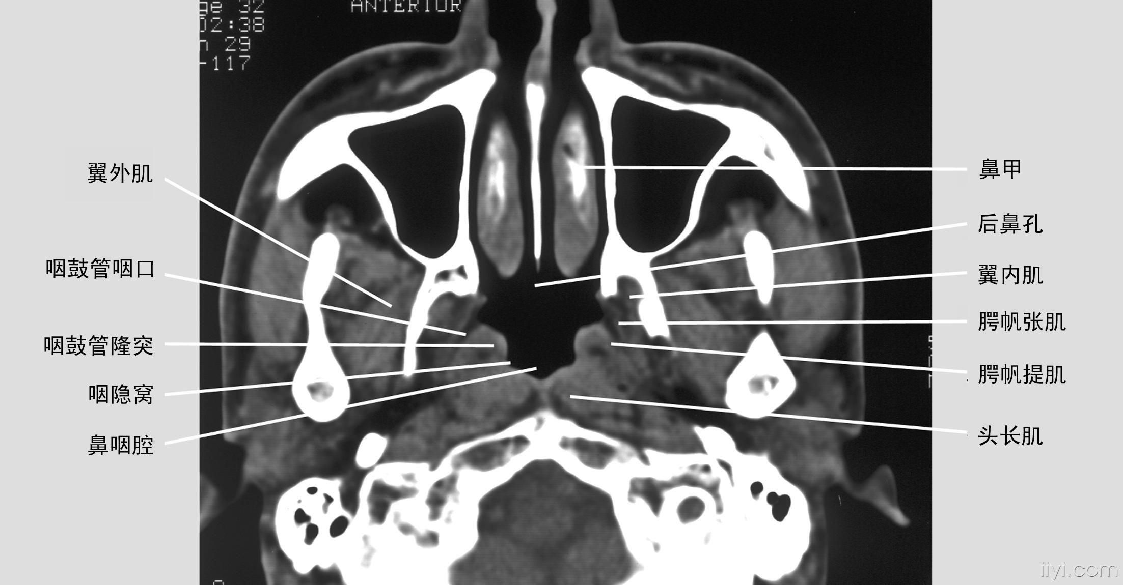 鼻咽癌的解剖图片