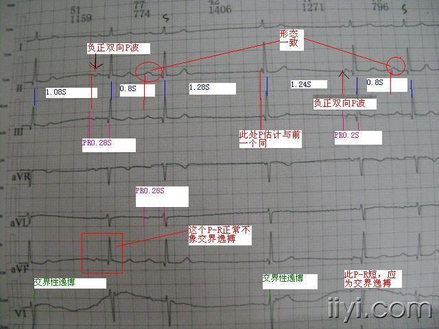 心电图脑电图专业讨论版