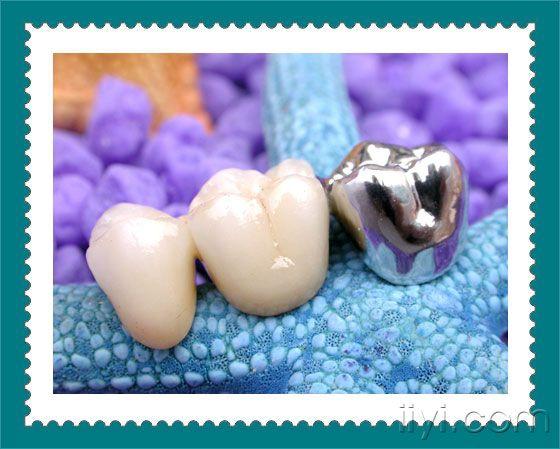 精美的烤瓷牙图片