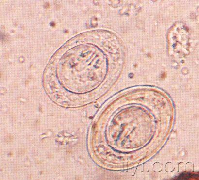 短膜壳绦虫卵图片图片
