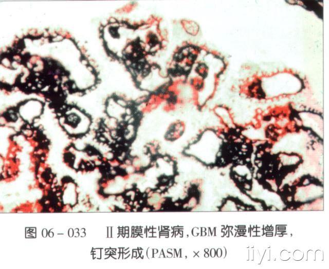 肾脏病理读片