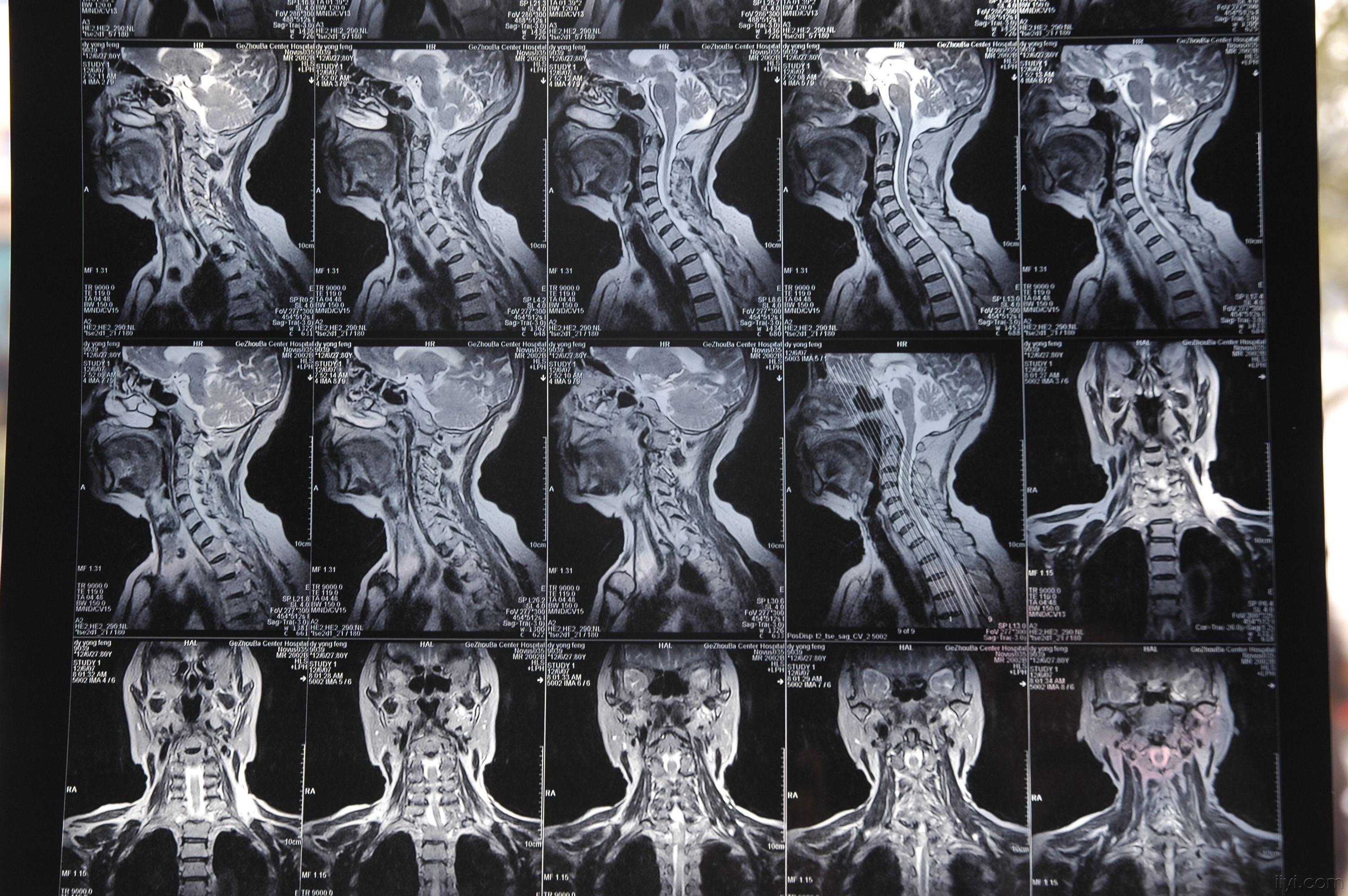 大家帮我看个片子