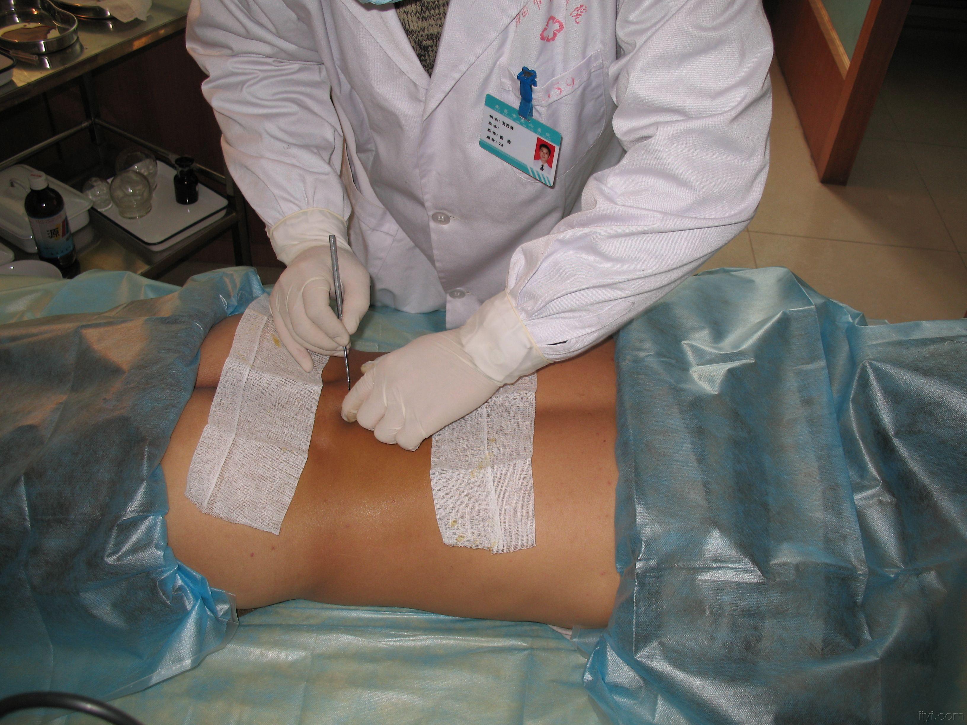 佛脚下的木鱼(万化由心)与朋友的聊天记录 - 中医针推外治版 - 爱爱医